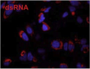 SCICONS Mouse anti double-stranded RNA (J2) 小鼠抗双链RNA单克隆抗体 (J2)